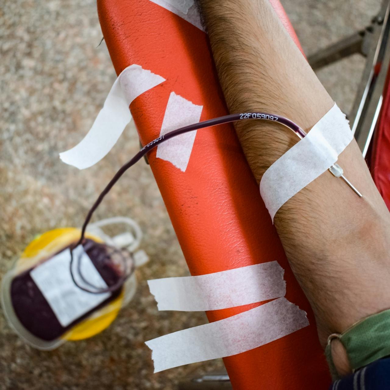 hero-homepage Detailed view of arm during blood donation, highlighting needle insertion and blood bag.